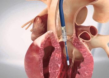 A 90 giorni dalla TAVI, il rischio di stroke e la mortalità sono sovrapponibili a quelli della popolazione generale